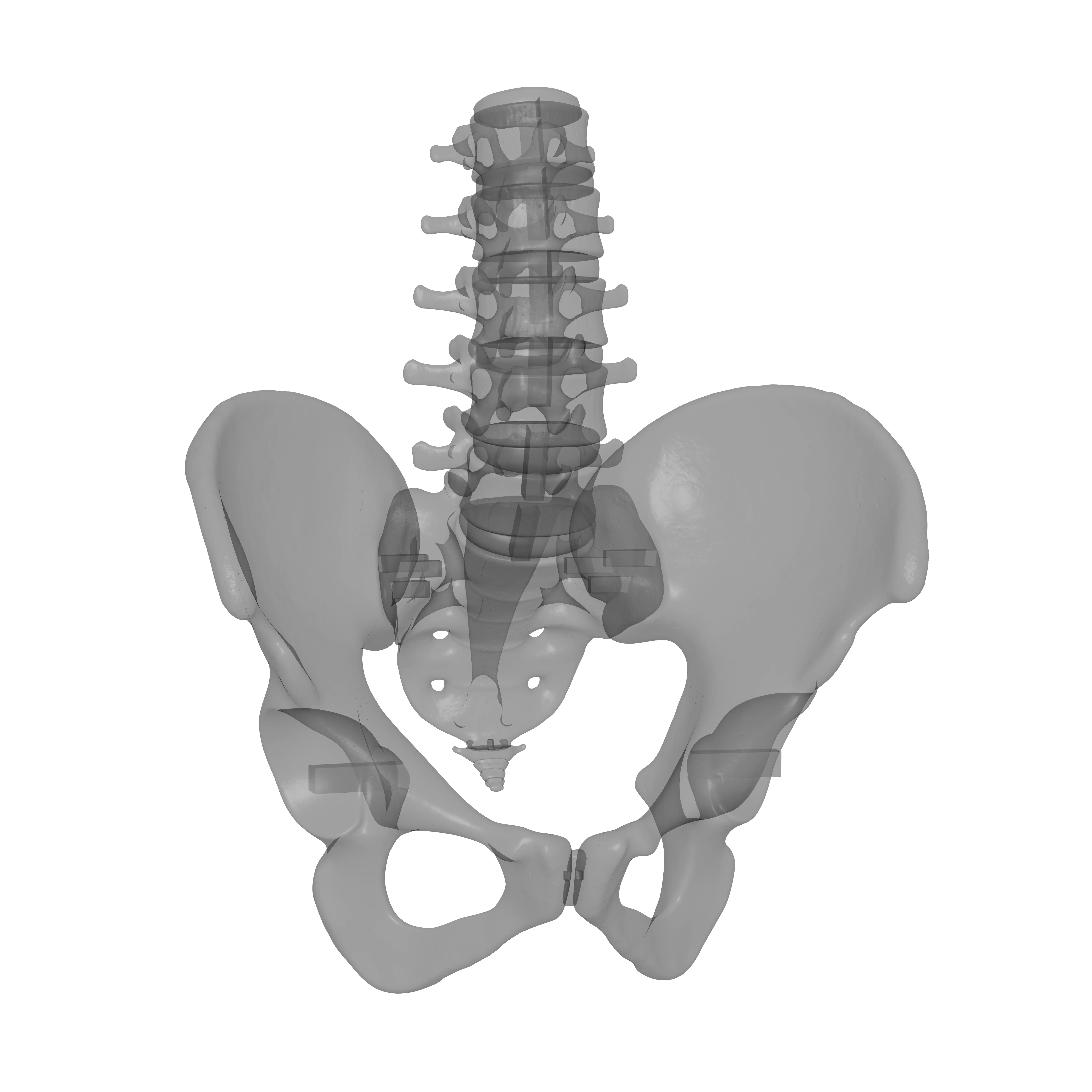 Lumbar Spine - Ilium 3D print model_13
