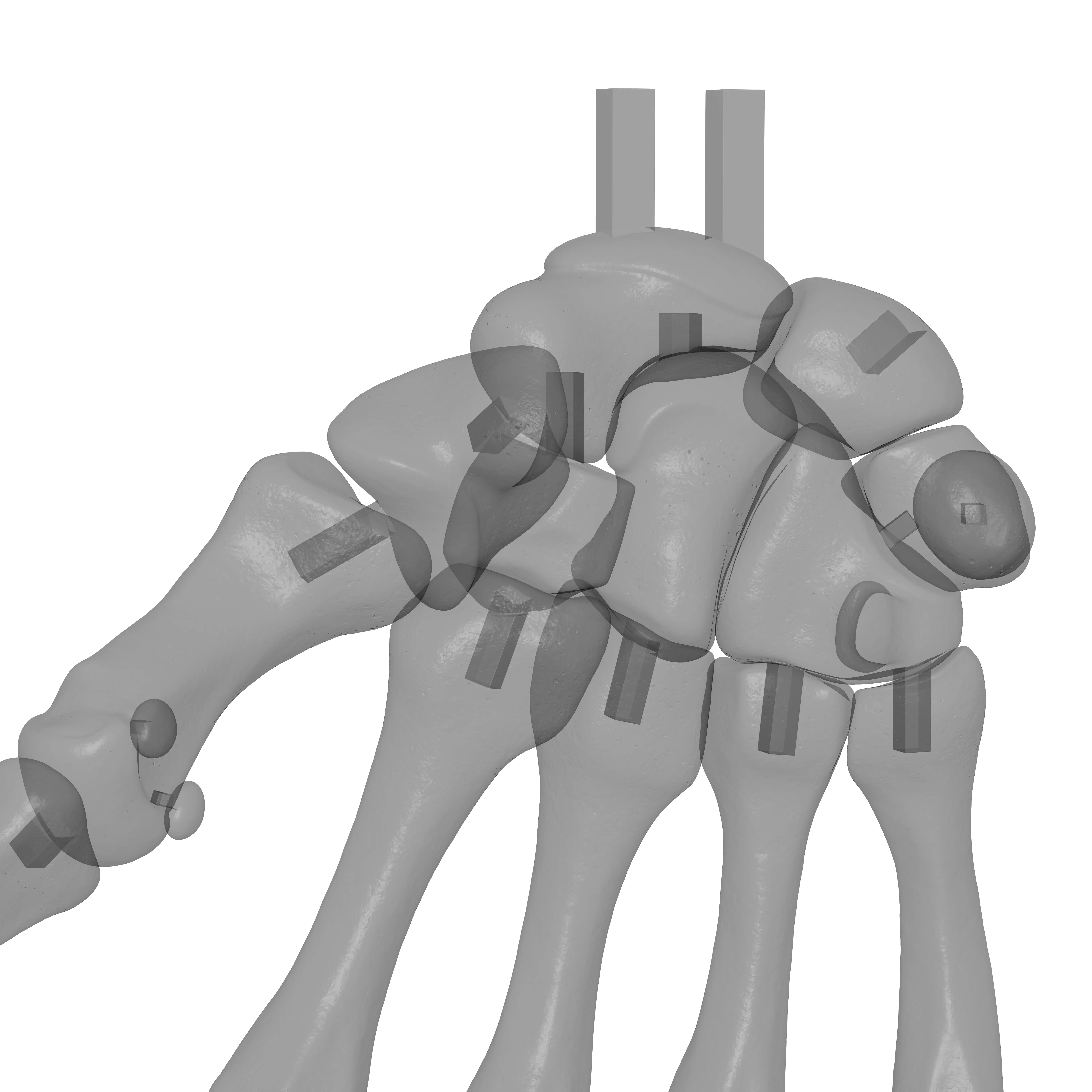 Human Rt Hand Bones 3D print model_23