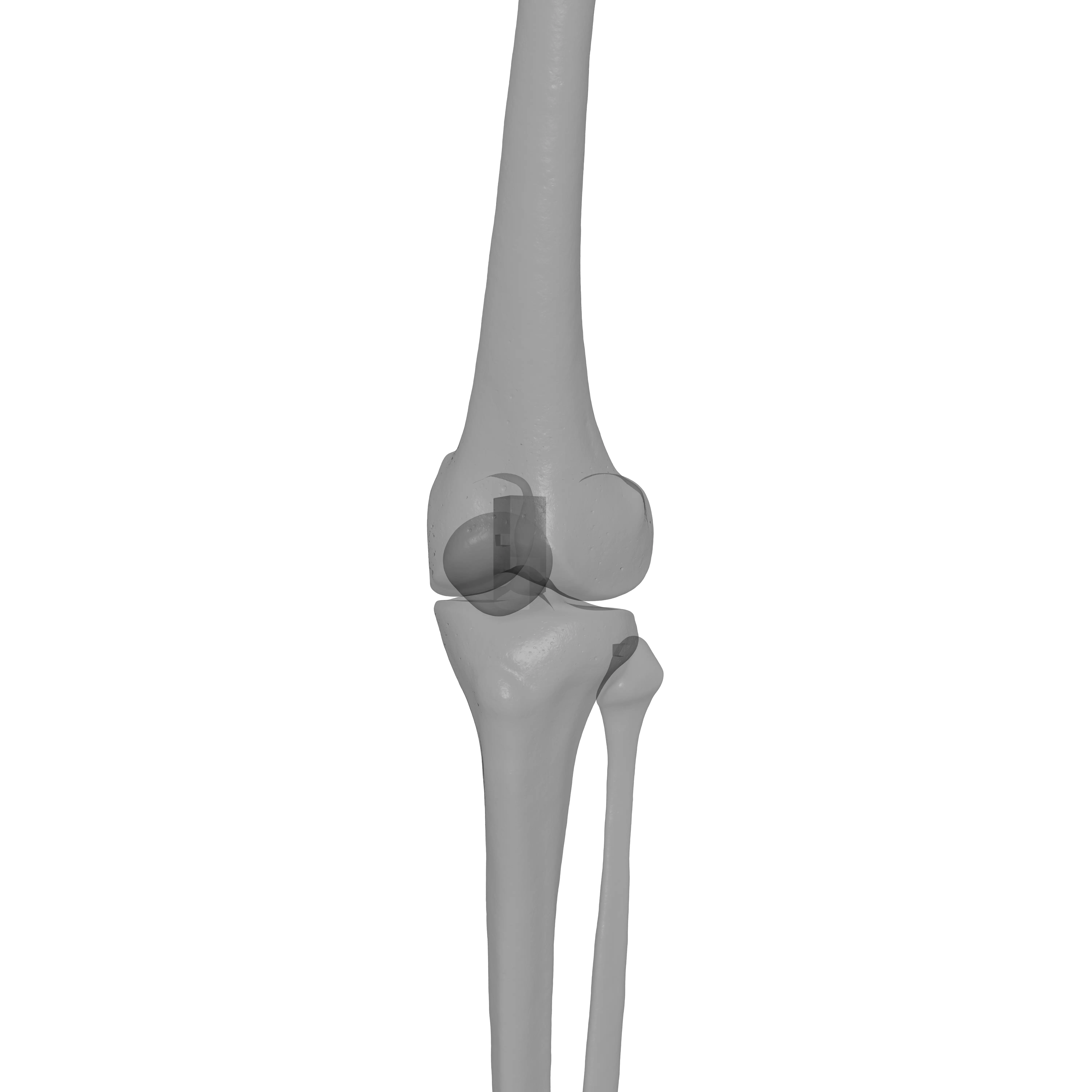 Human Lt Leg and Foot Bones 3D print model_29