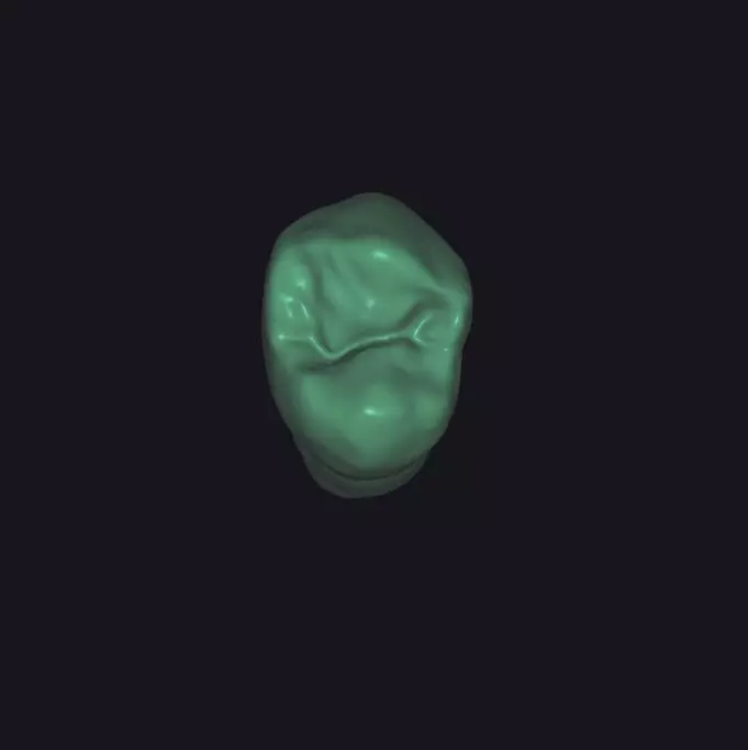 Tooth 14 with and without base Free 3D print model