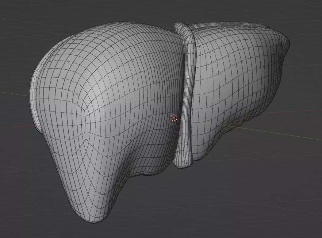 Liver Damage Stages Low-poly 3D model_16
