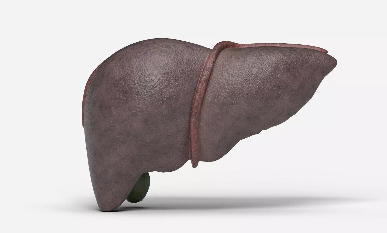 Liver Damage Stages Low-poly 3D model_10