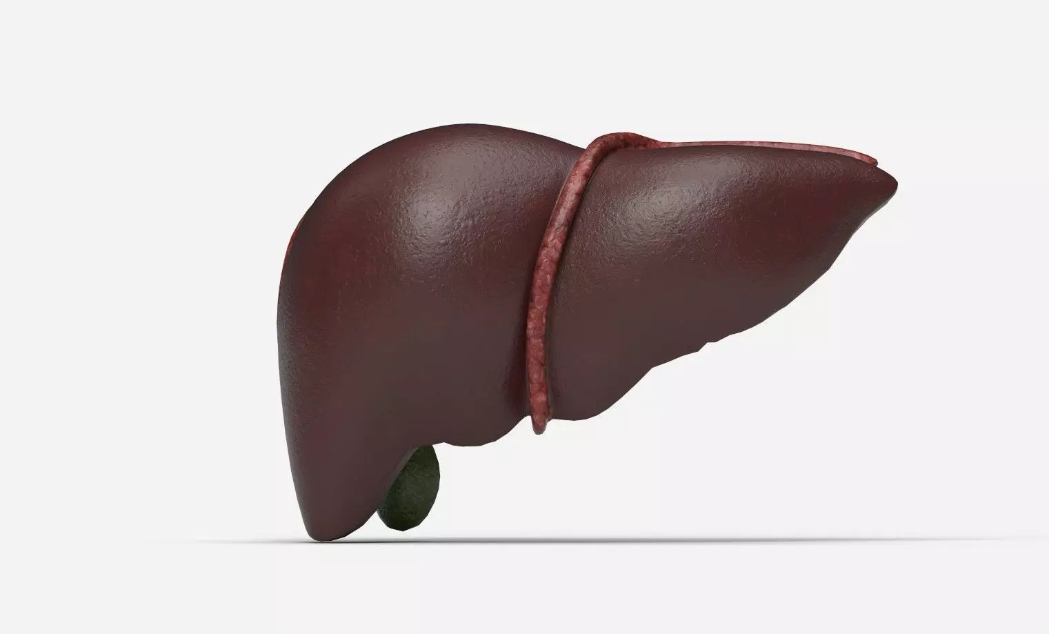Liver Damage Stages Low-poly 3D model_8