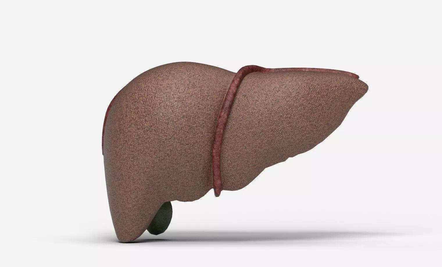 Liver Damage Stages Low-poly 3D model_11