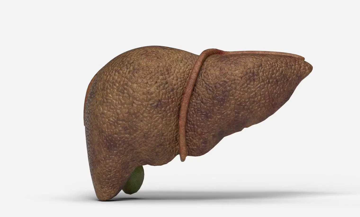 Liver Damage Stages Low-poly 3D model_13
