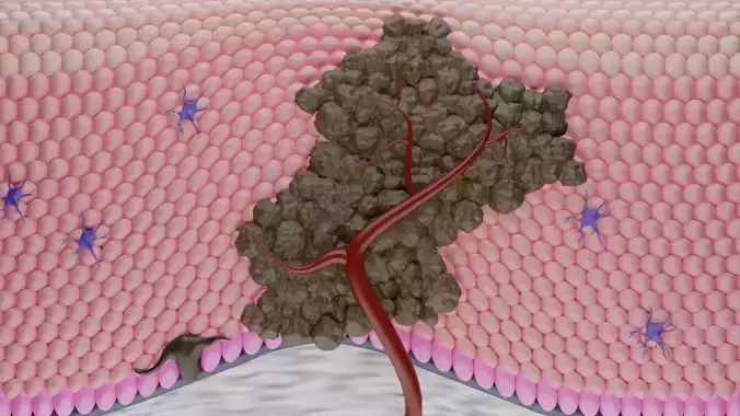 3d model of Cancer cell and animation