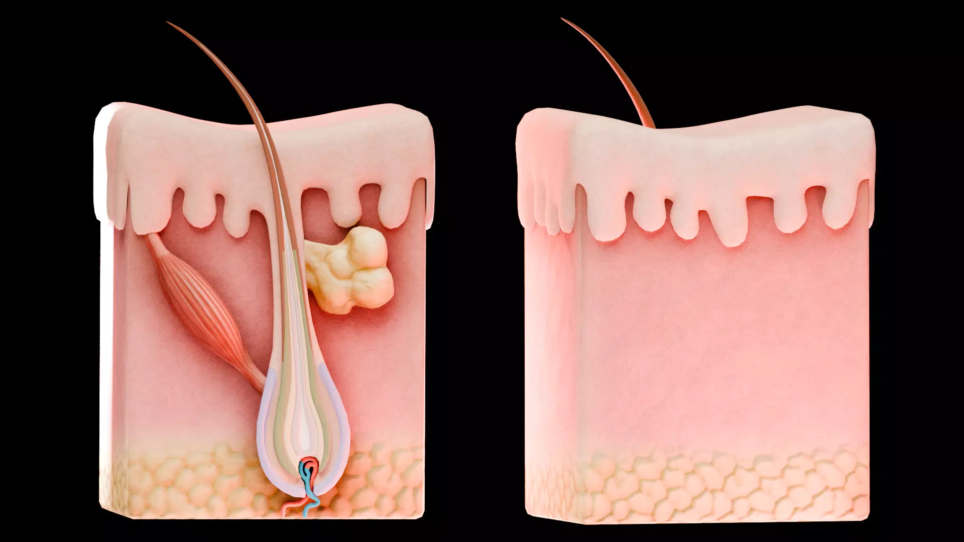Human Skin Dermal Papillae Structure Low-poly 3D model_4
