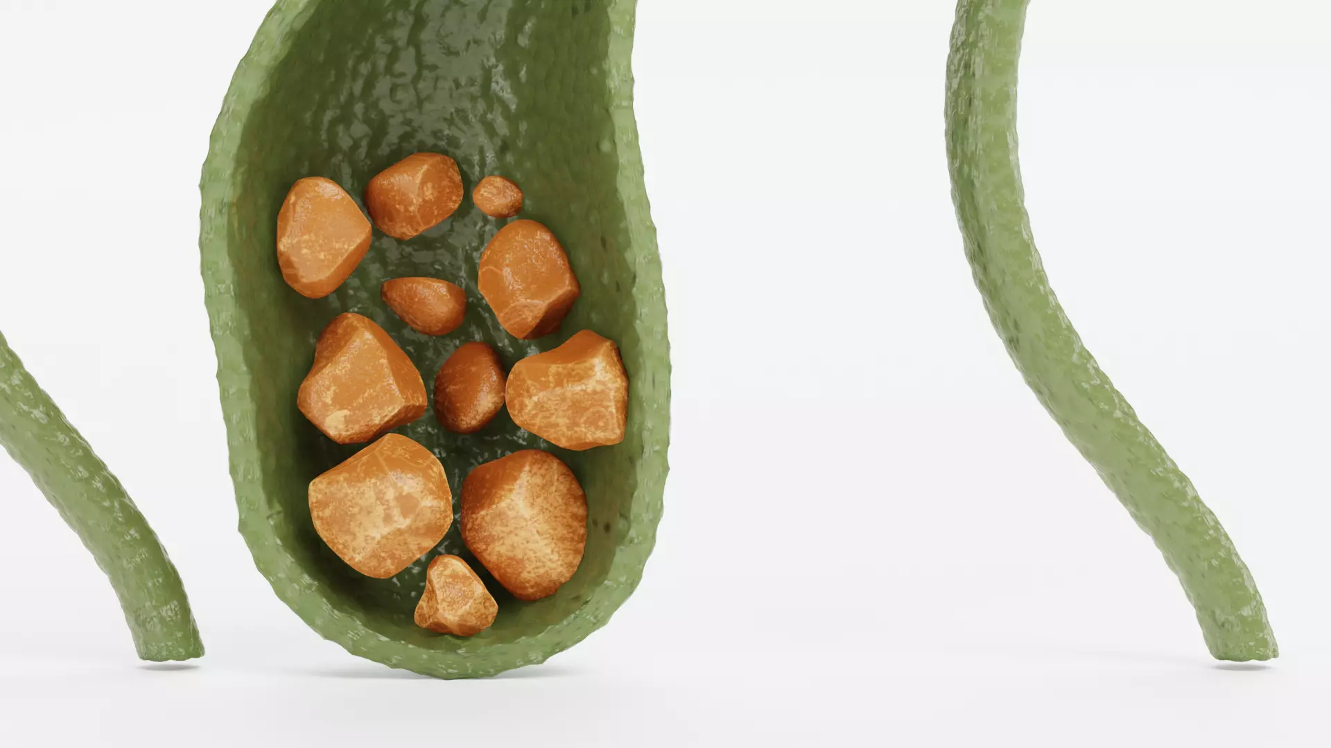 Gallbladder Set - Full Human Organ with Section and Gallstones  3D model_6