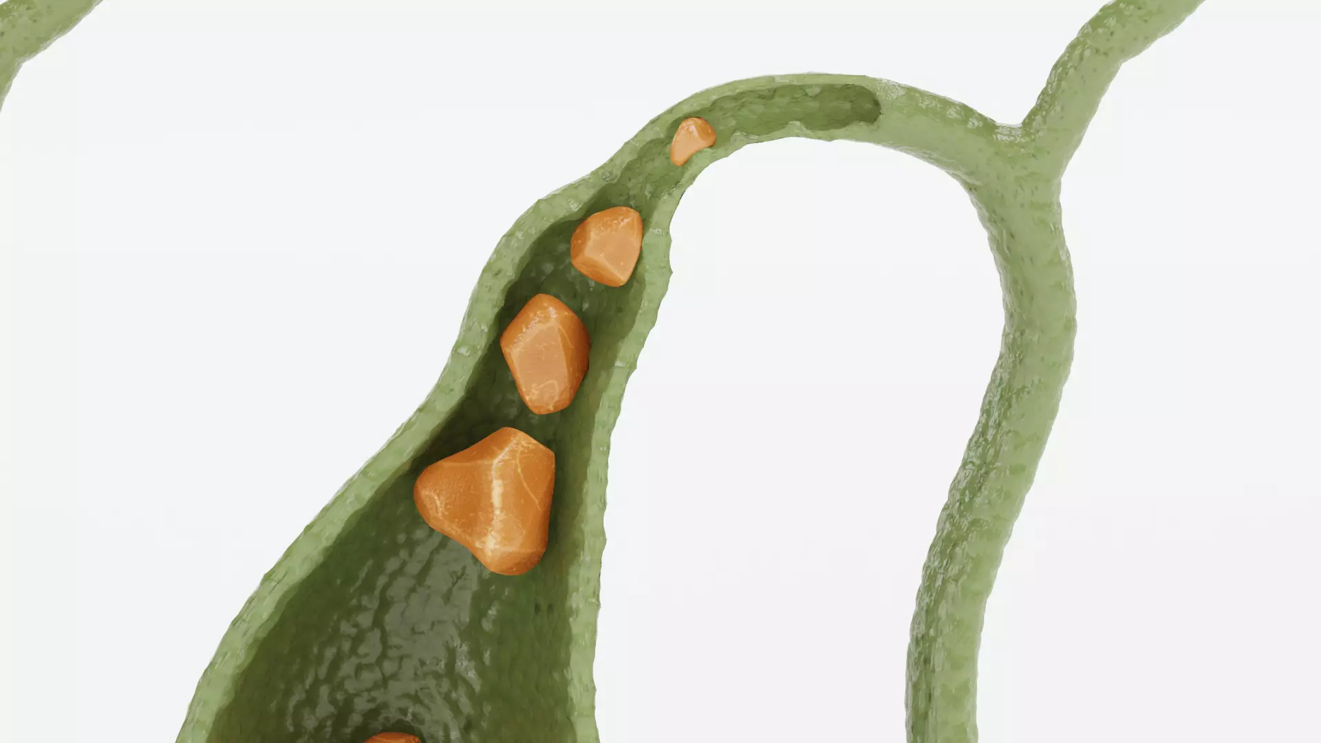 Gallbladder Set - Full Human Organ with Section and Gallstones  3D model_7