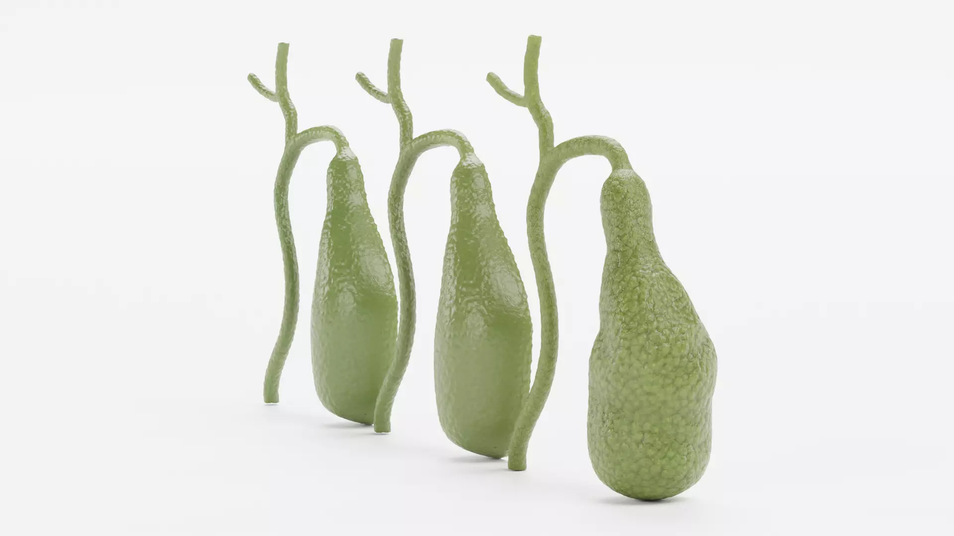 Gallbladder Set - Full Human Organ with Section and Gallstones  3D model_3