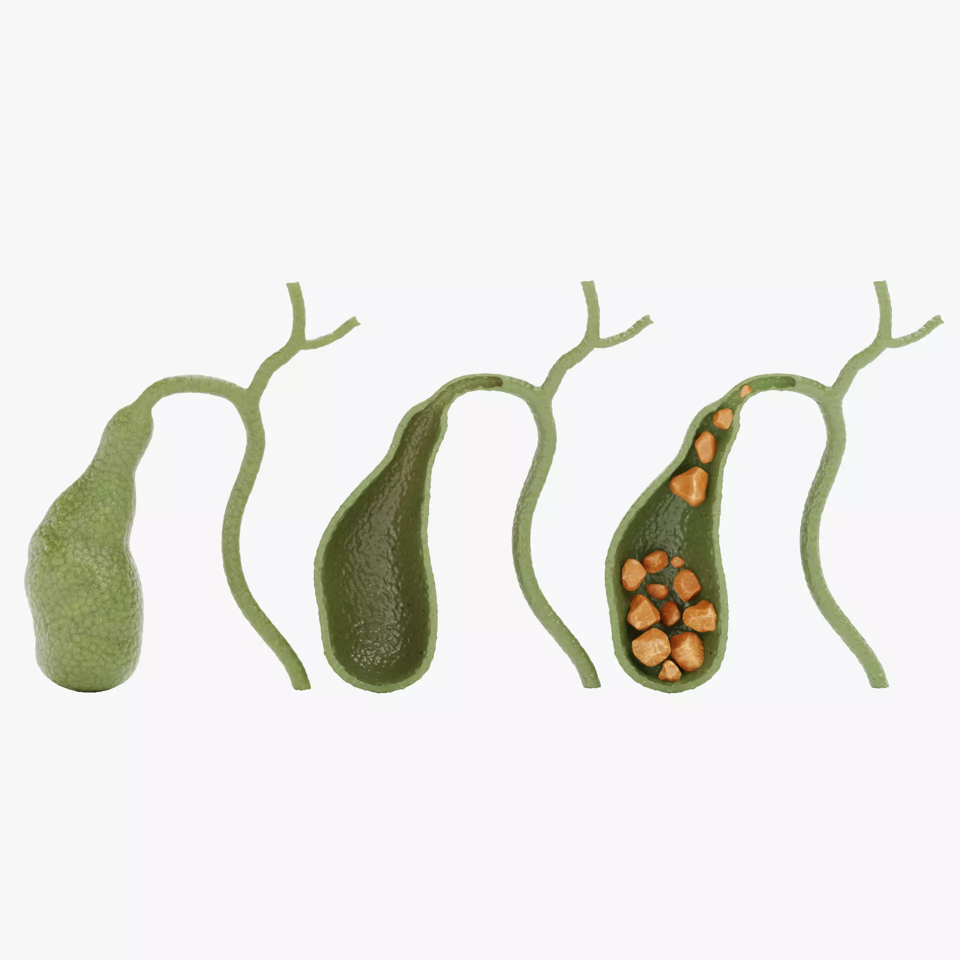 Gallbladder Set - Full Human Organ with Section and Gallstones  3D model_15