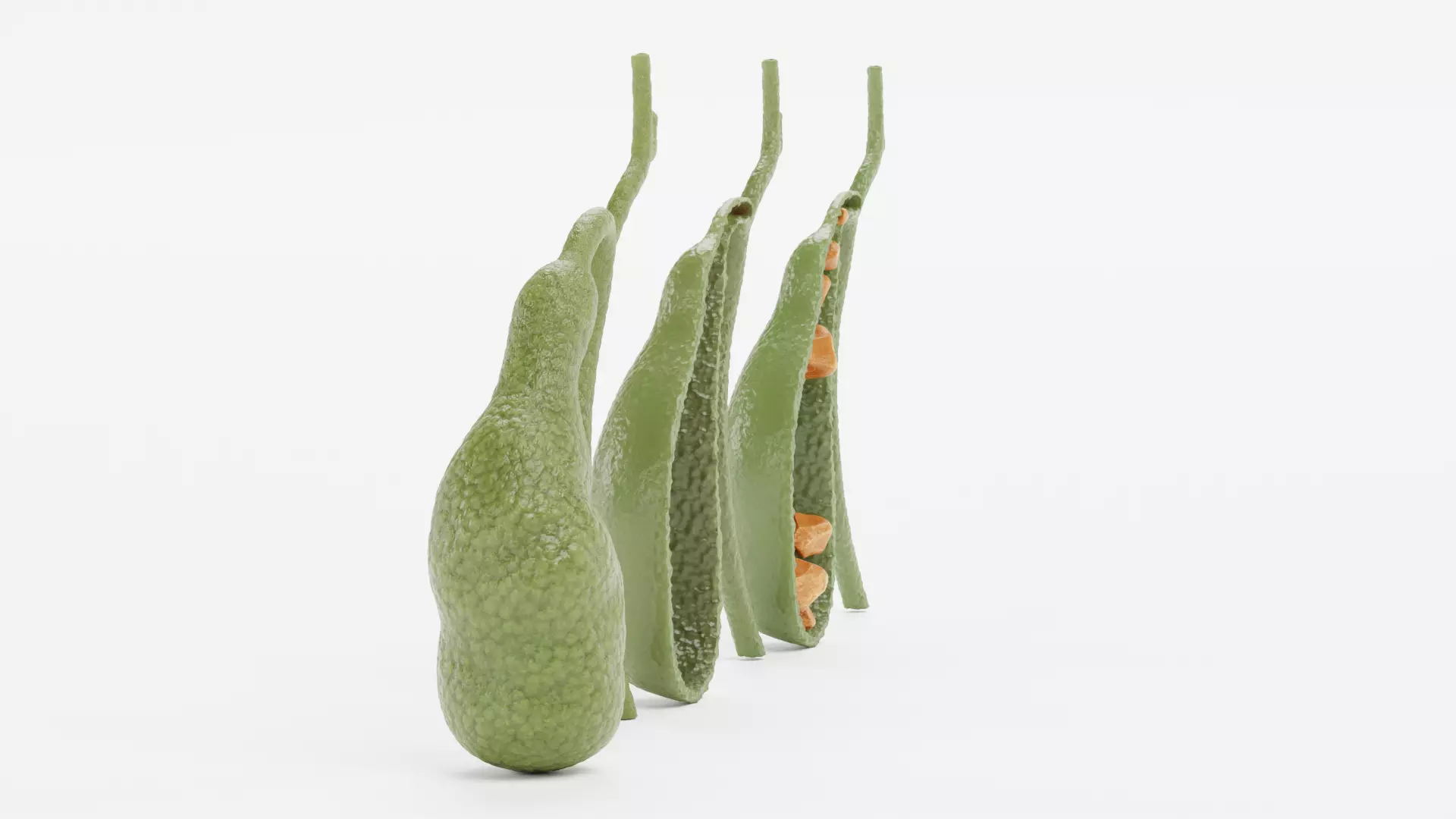 Gallbladder Set - Full Human Organ with Section and Gallstones  3D model_2