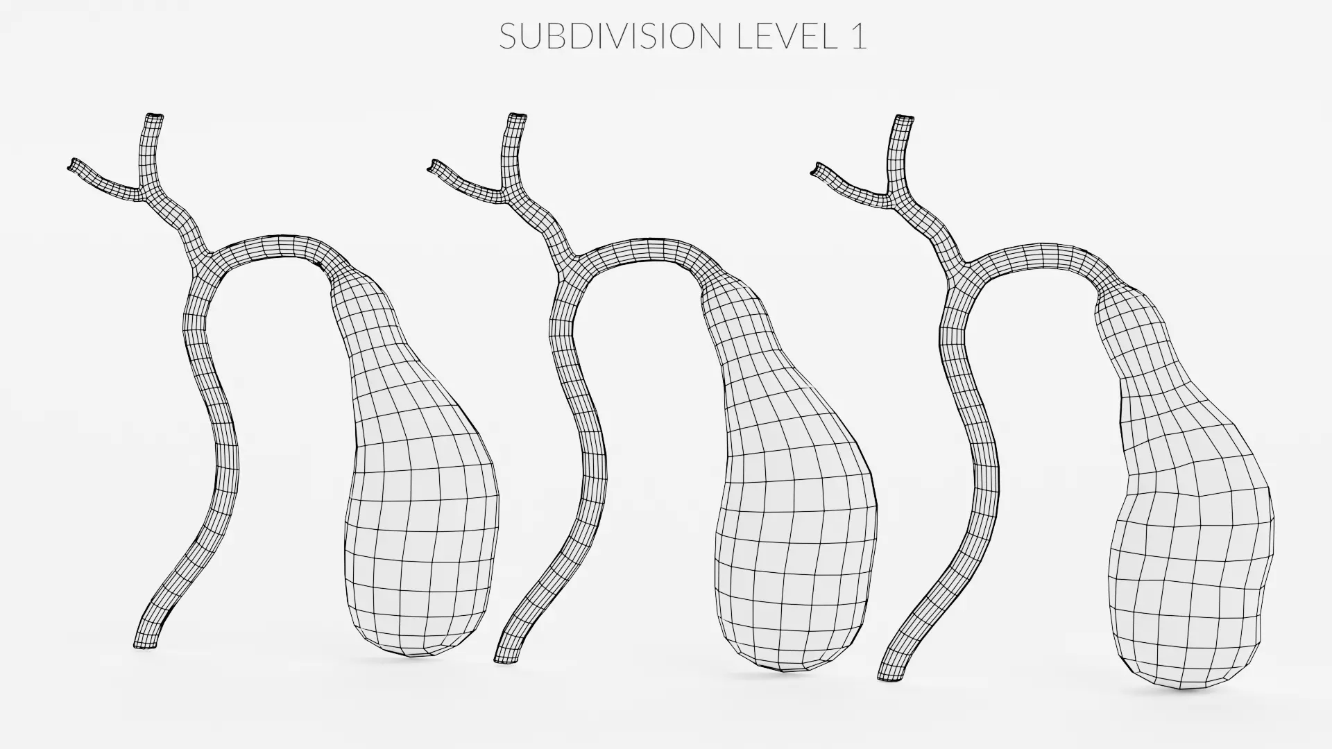 Gallbladder Set - Full Human Organ with Section and Gallstones  3D model_16
