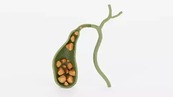 Gallbladder Section with Gallstones - Realistic Human Anatomy 3D model