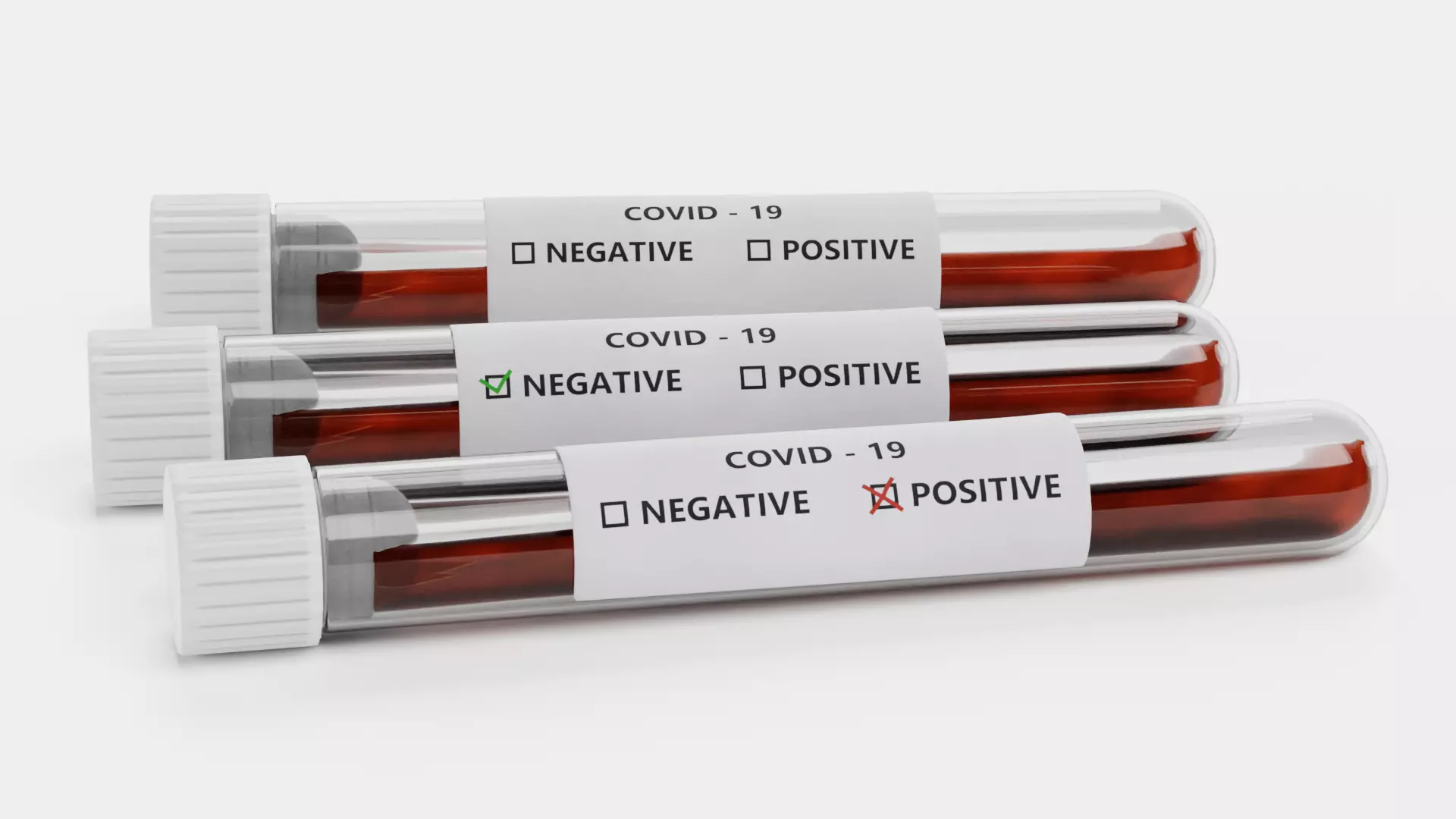 Test Tube Set - COVID-19 Blood Samples with Medical Labels 3D model
