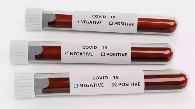 -Test Tubes for Covid-19 Test-