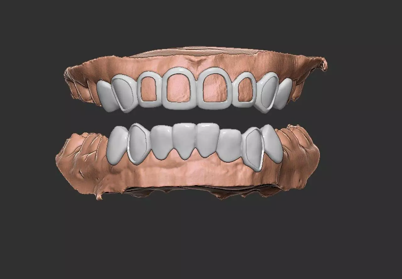 CUSTOM GRILLZ DESIGN 3D print model
