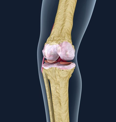 Osteoporosis of the knee joint 3D model