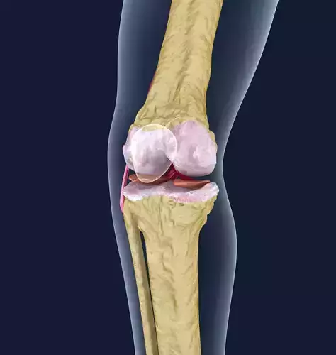 Osteoporosis of the knee joint 3D model