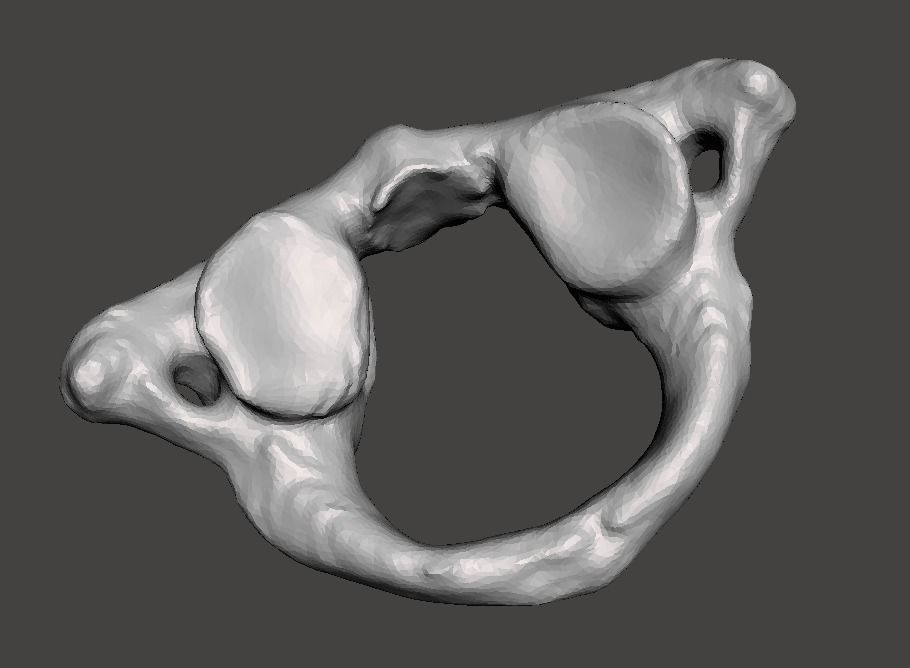 1st Cervical Vertebra - female 3D model_20