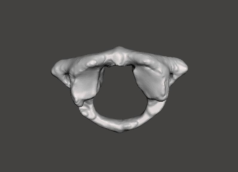 1st Cervical Vertebra - female 3D model_16