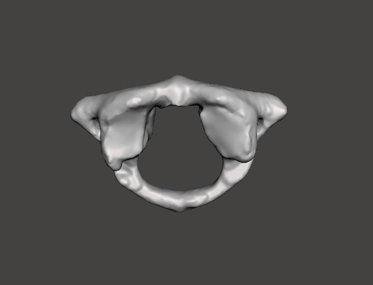 1st Cervical Vertebra - female 3D model_11