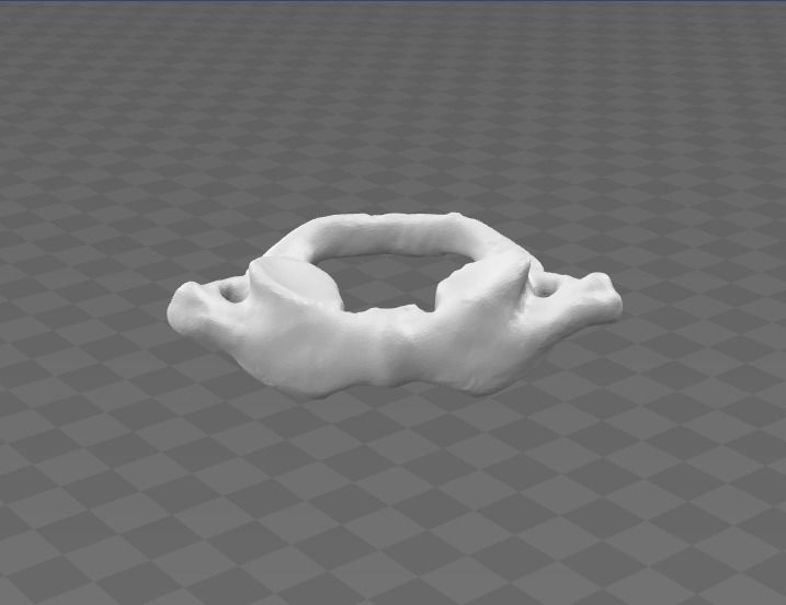 1st Cervical Vertebra - female 3D model_9
