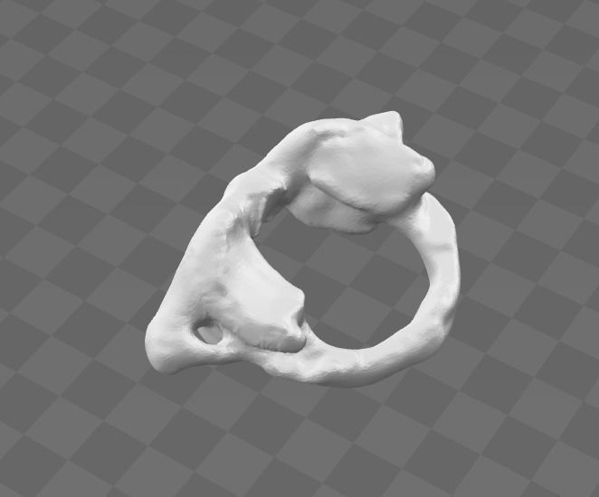 1st Cervical Vertebra - female 3D model_2
