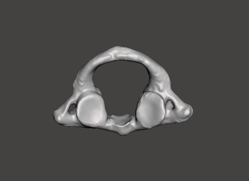 1st Cervical Vertebra - female 3D model_27