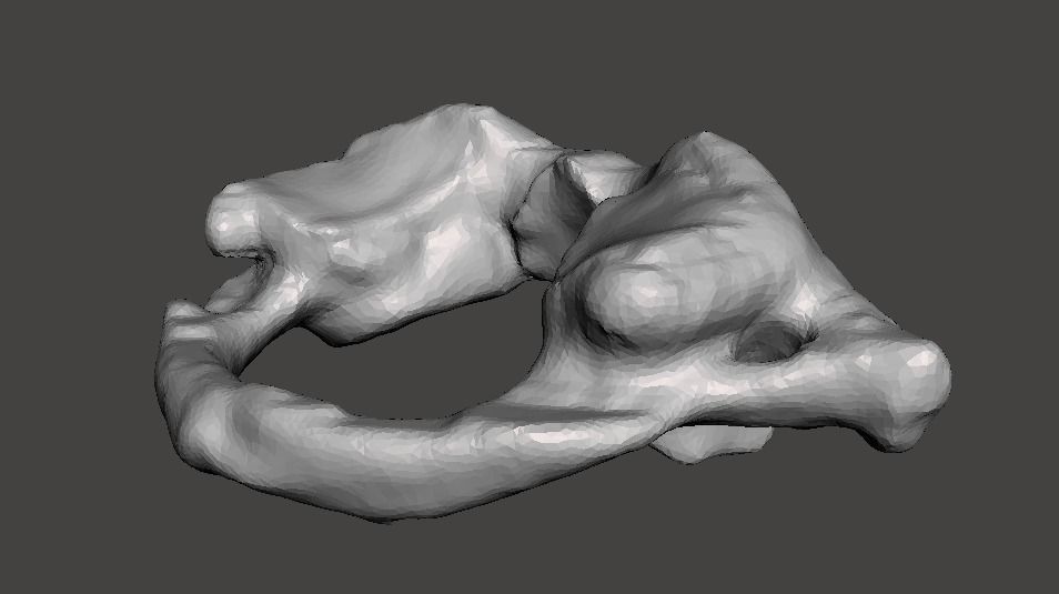 1st Cervical Vertebra - female 3D model_10