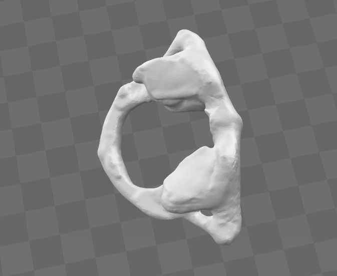 1st Cervical Vertebra - female 3D model_4