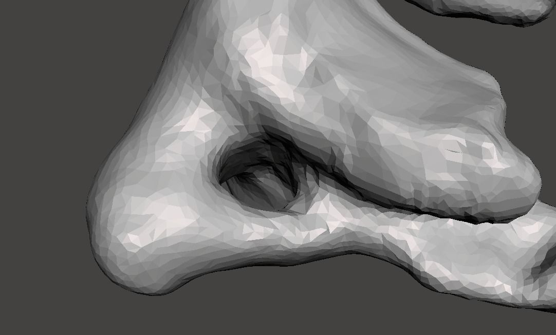 1st Cervical Vertebra - female 3D model_23