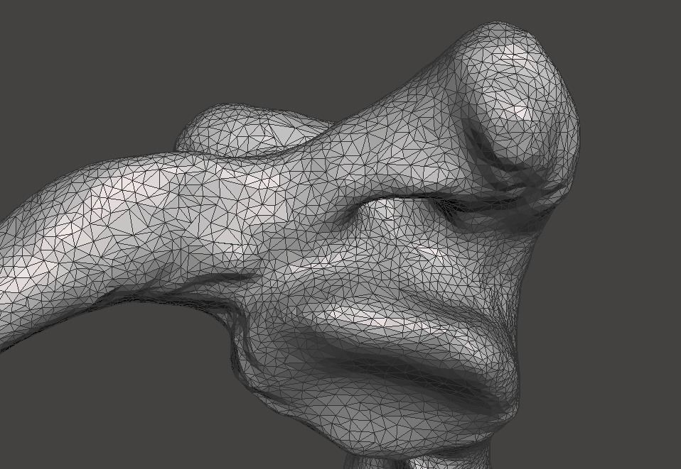 1st Cervical Vertebra - female 3D model_19