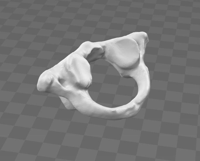 1st Cervical Vertebra - female 3D model_7