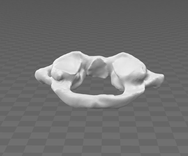 1st Cervical Vertebra - female 3D model_3