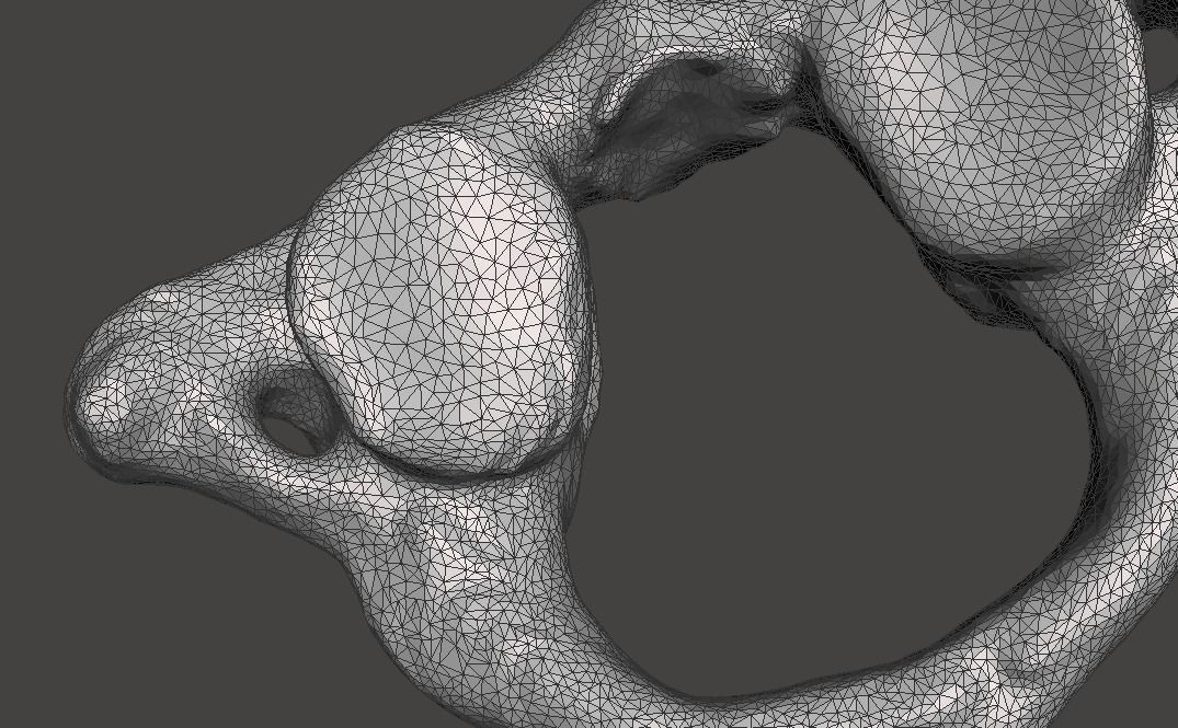 1st Cervical Vertebra - female 3D model_21
