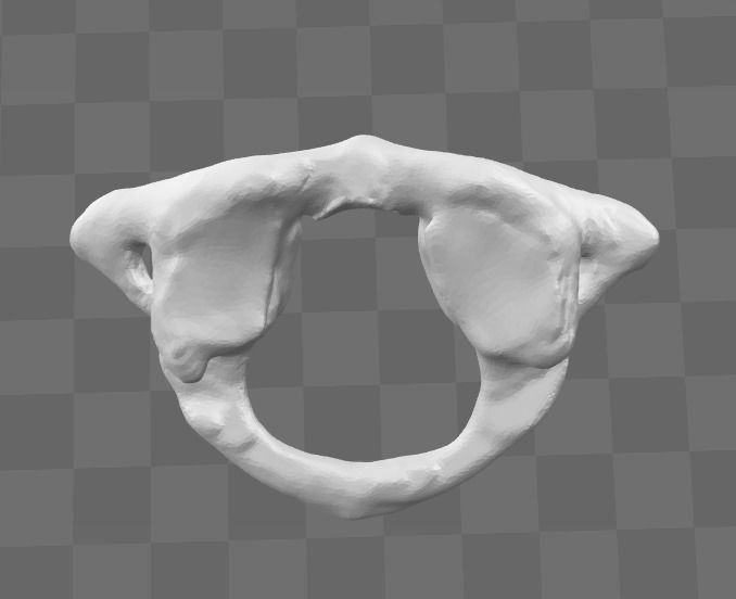 1st Cervical Vertebra - female 3D model_0