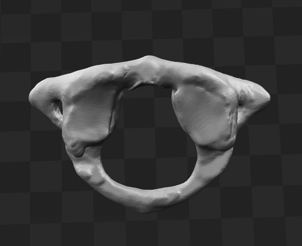 1st Cervical Vertebra - female 3D model