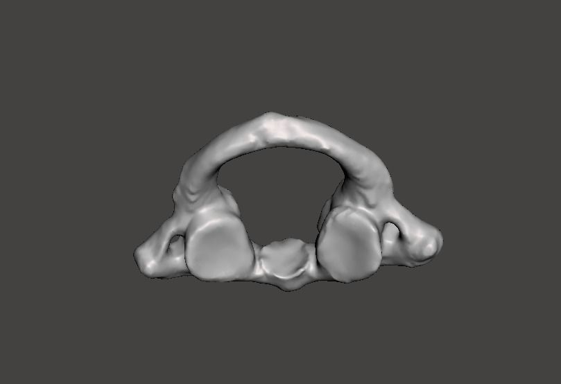 1st Cervical Vertebra - female 3D model_25
