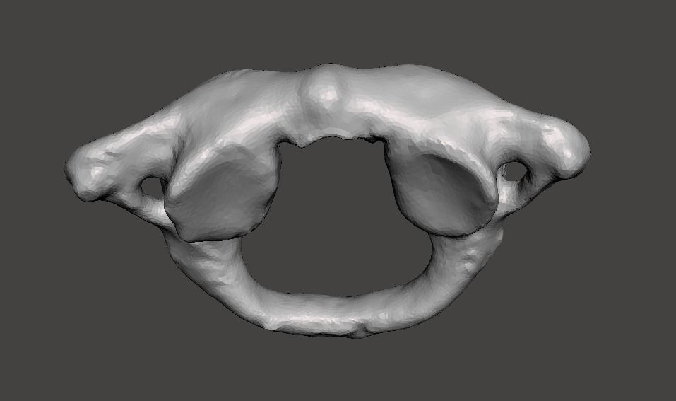 1st Cervical Vertebra - female 3D model_12
