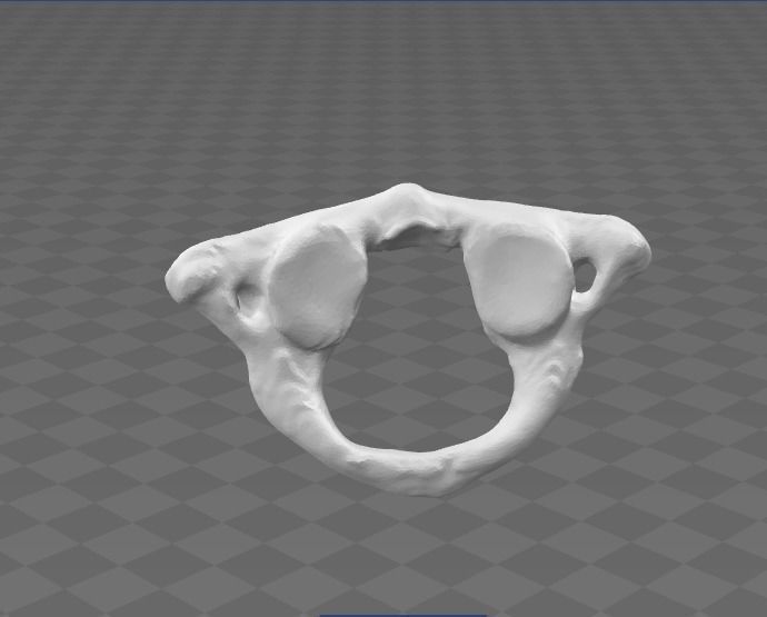 1st Cervical Vertebra - female 3D model_8