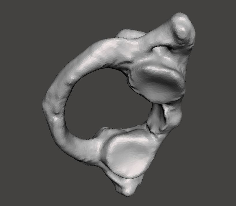 1st Cervical Vertebra - female 3D model_17