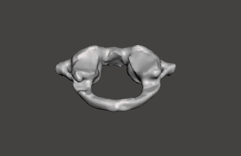 1st Cervical Vertebra - female 3D model_29