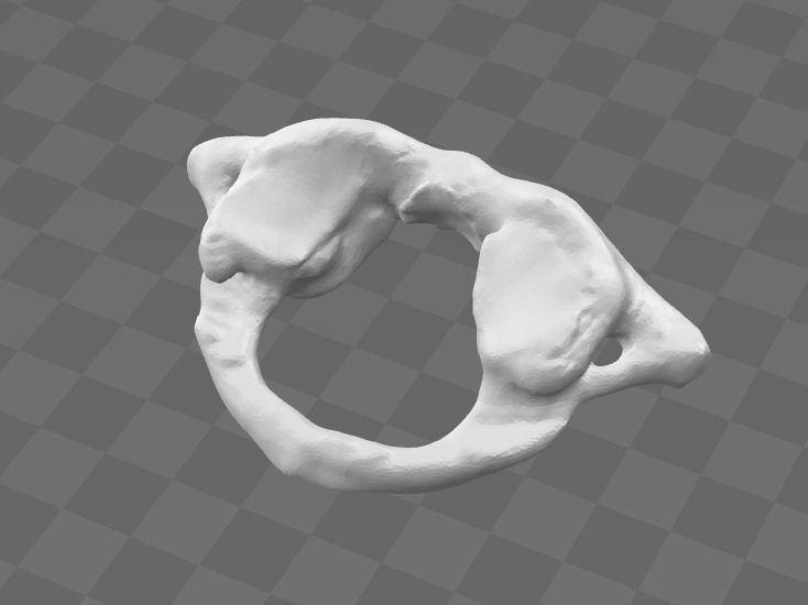 1st Cervical Vertebra - female 3D model_1