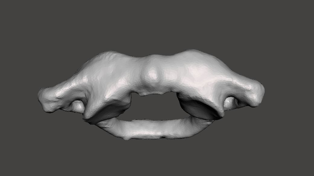 1st Cervical Vertebra - female 3D model_22
