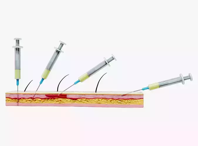 Types of Injections With Animation 3D model