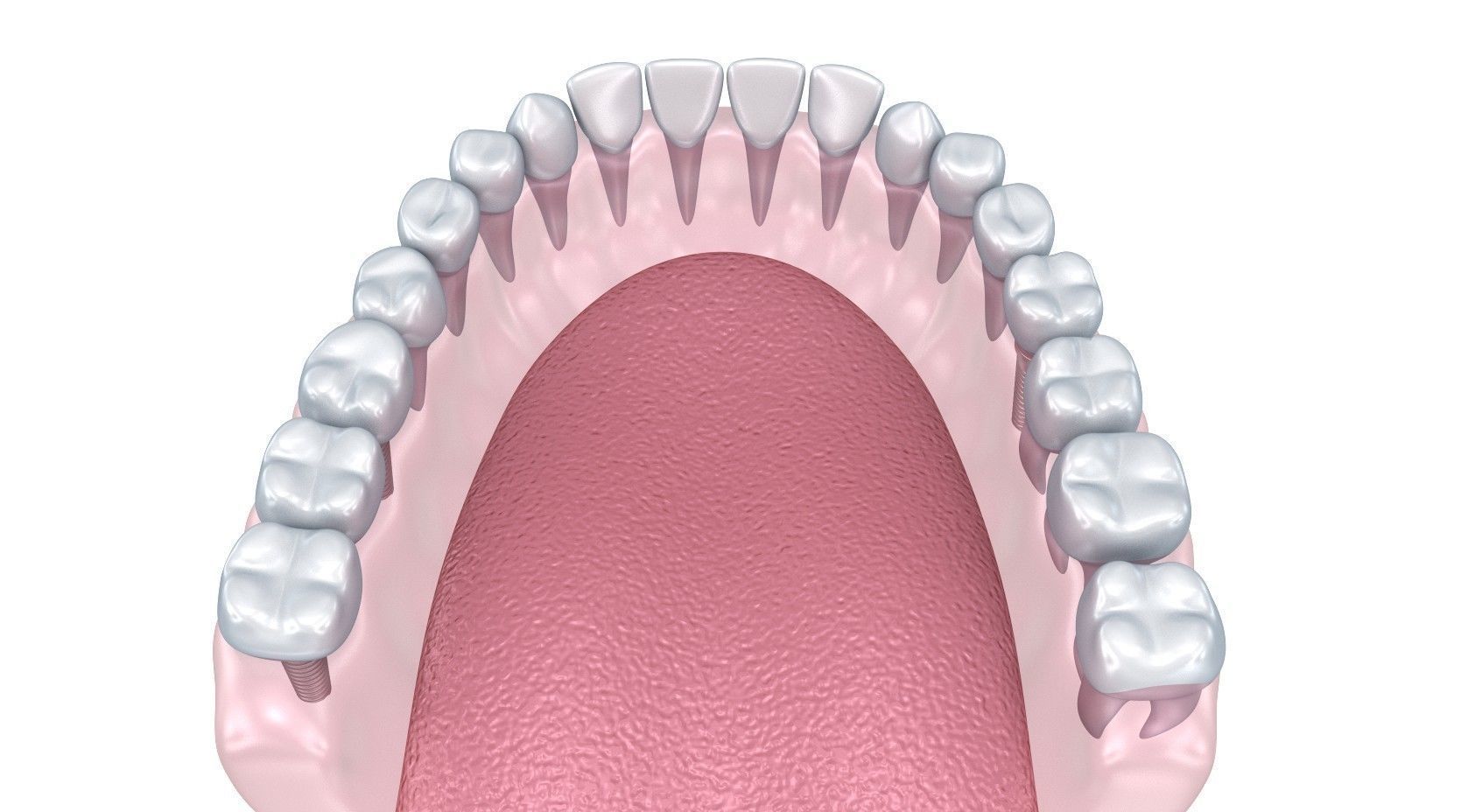 Human Lower teeth crown and dental implant  3D model_9