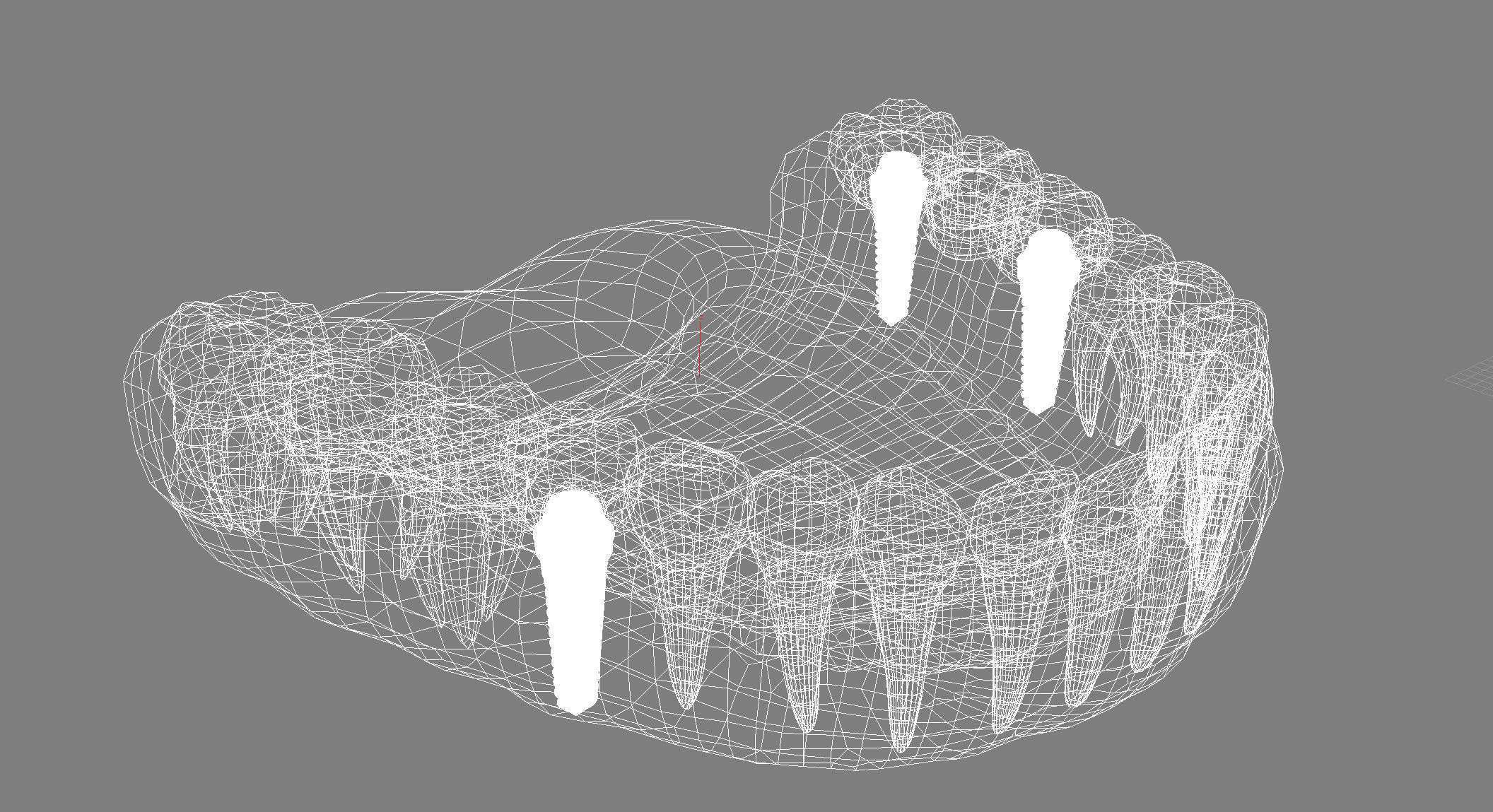 Human Lower teeth crown and dental implant  3D model_11