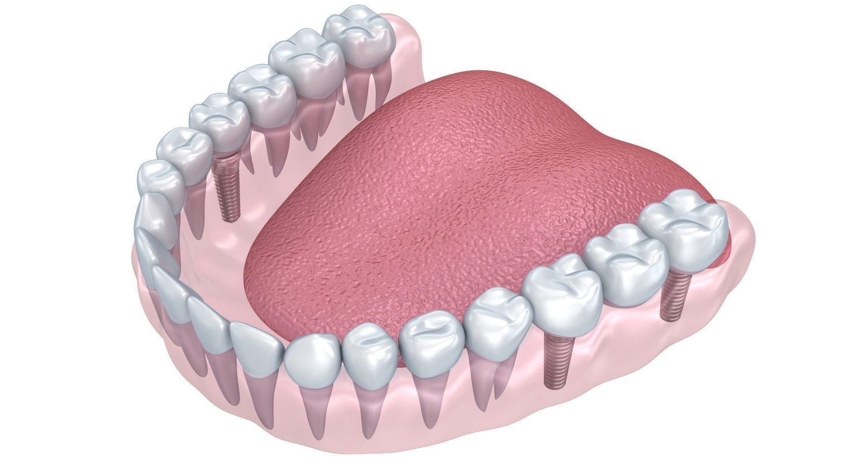 Human Lower teeth crown and dental implant  3D model_8