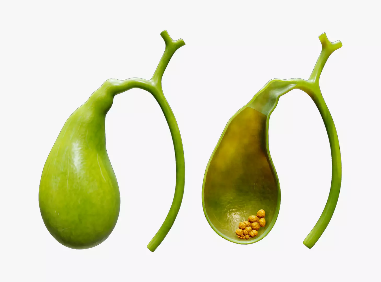Gallbladder and Gallbladder Cross Section 3D model